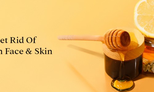 How To Get Rid Of Dark Spots On Face & Skin